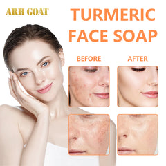 ARHGOAT Skin Lightening Kojic Acid Soap - Before & After Results