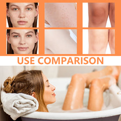 ARHGOAT Skin Lightening Kojic Acid Soap - Use Comparison